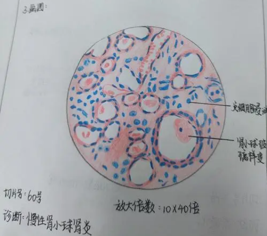 病理学成绩差怎么办？(病理学挂了怎么办)