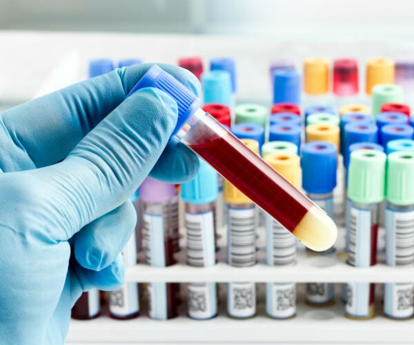 英国皇家霍洛威大学Biomedical Sciences 生物医学科学辅导