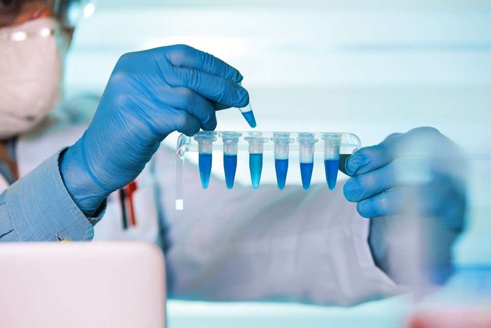 英国伦敦大学国王学院Biomedical Engineering BEng生物医学工程辅导