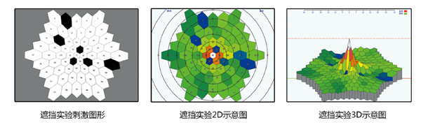 nyu vept test面试培训会遇到那些问题呢？